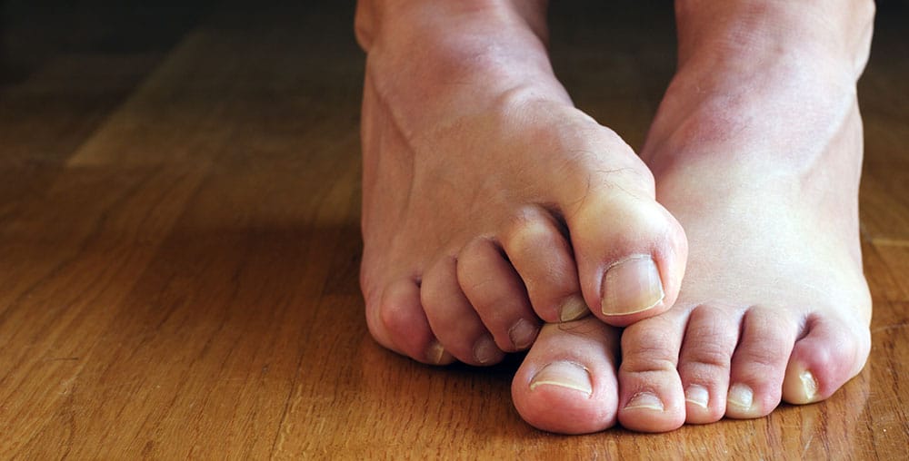 foot embarrasment Foot embarrasment